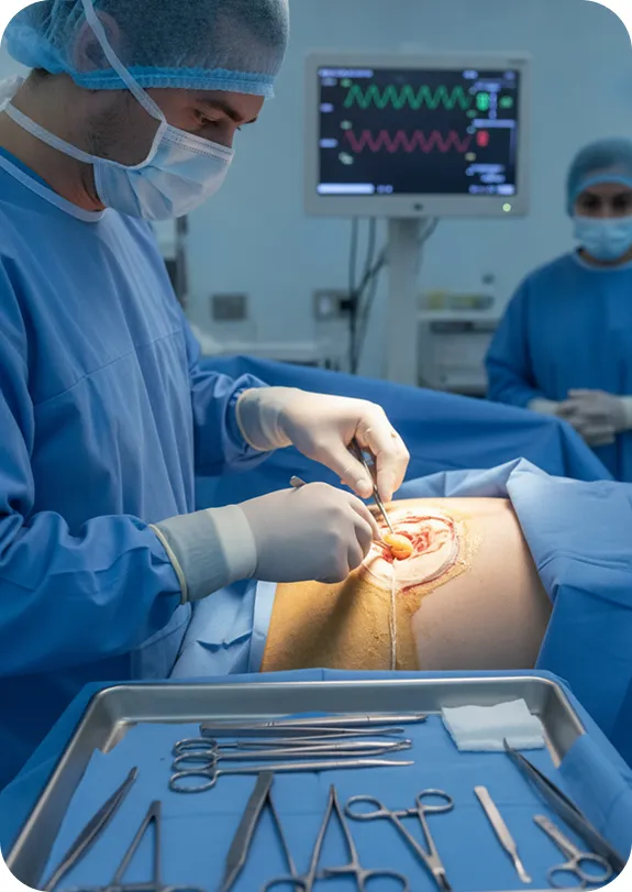 Our Complete Lipoma Removal Service in Surrey