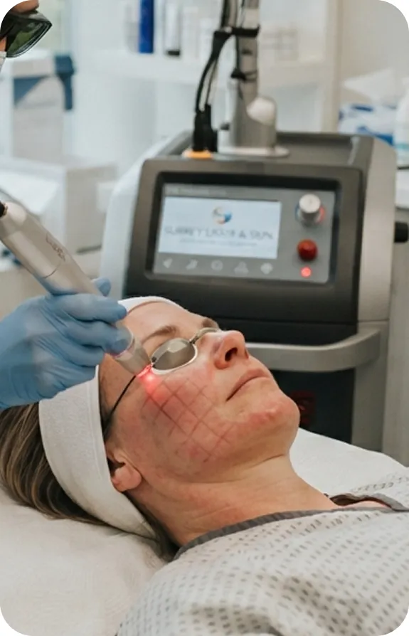 Laser Skin Resurfacing in Surrey